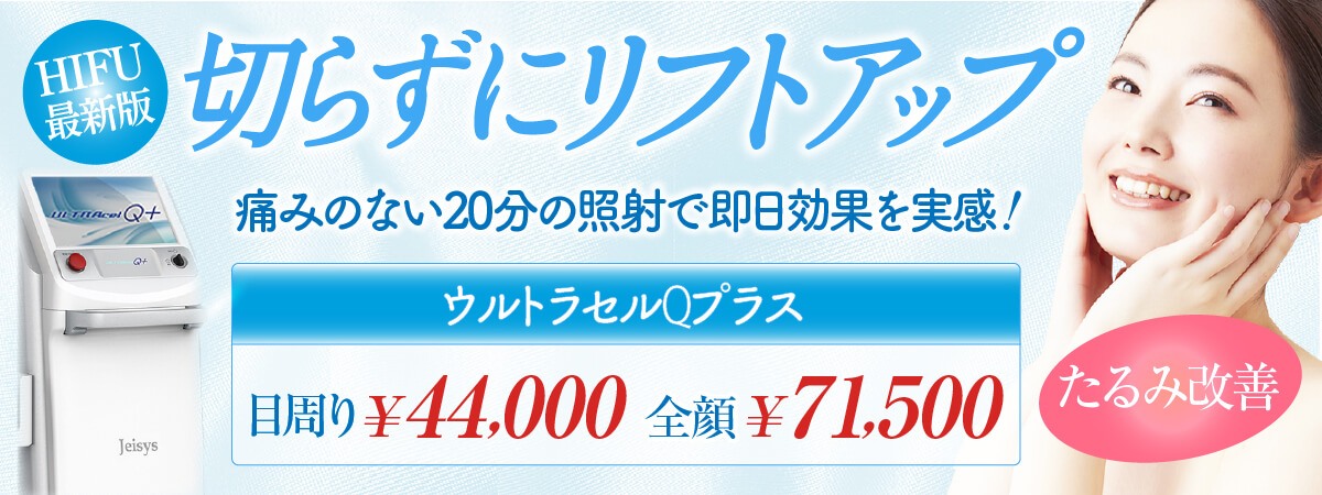 月曜日はシミがお得