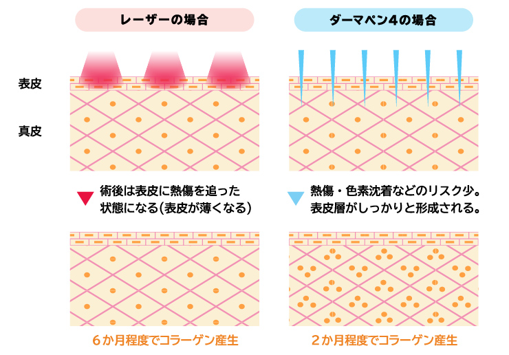 ヴェルヴェットスキンイメージ