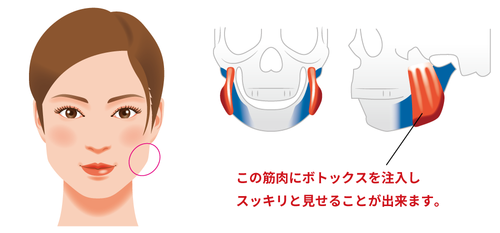 脱脂の治療方法