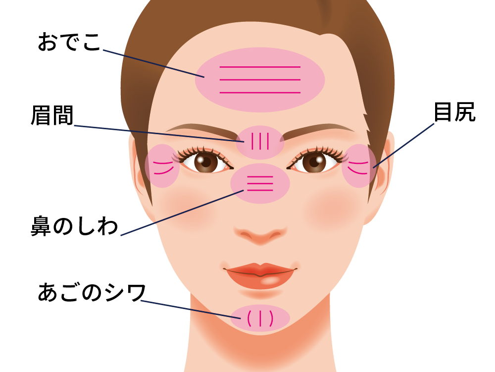 脱脂の治療方法