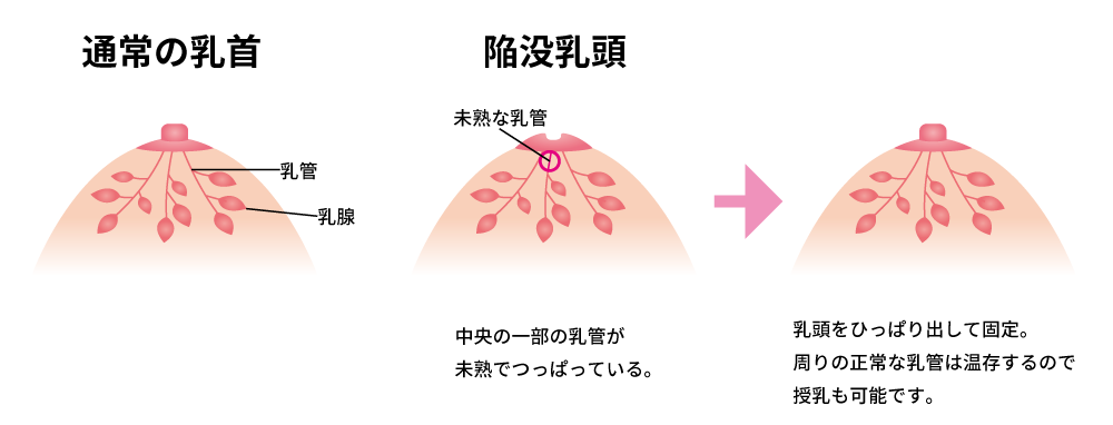 治療方法