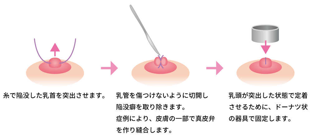 脱脂の治療方法