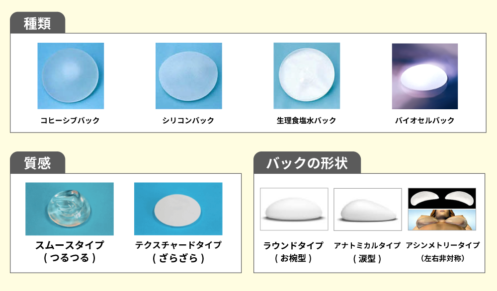 豊胸術（シリコンバッグ挿入）とは