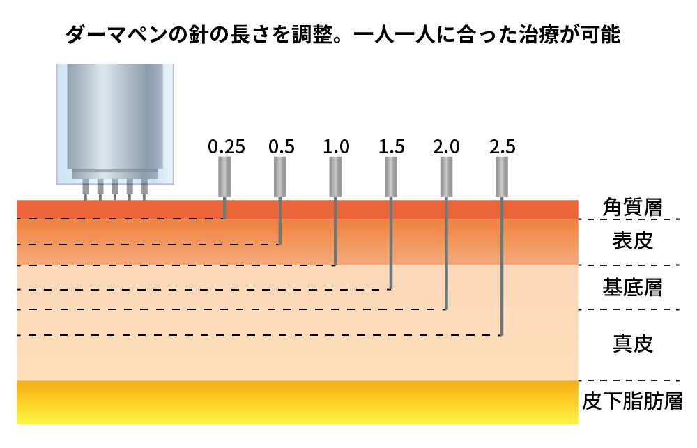 ダーマペンとは