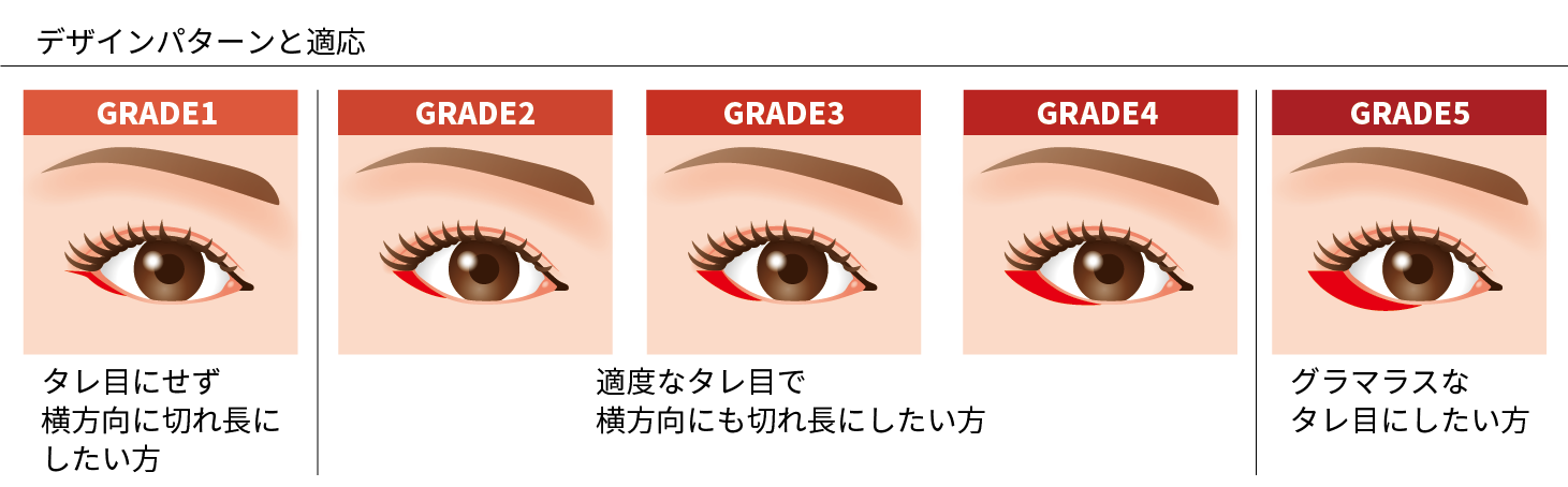 目尻切開術の治療方法