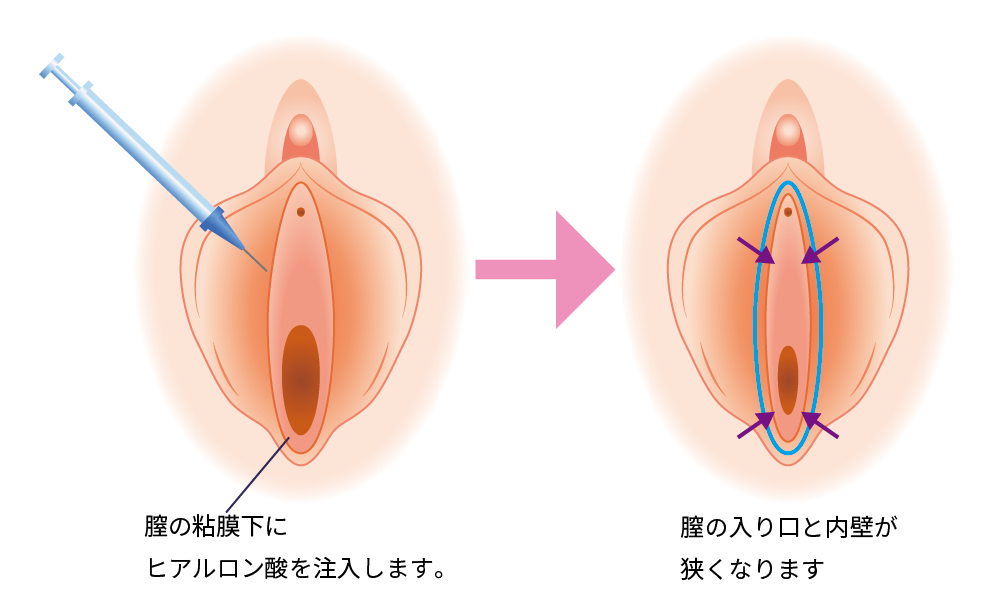 脱脂の治療方法