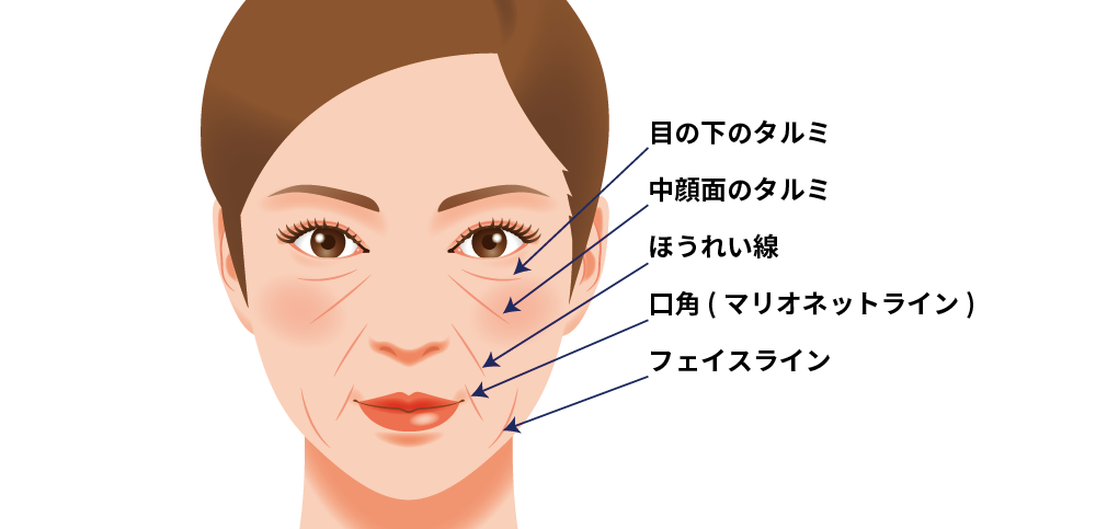 ヒアルロン酸注入の治療