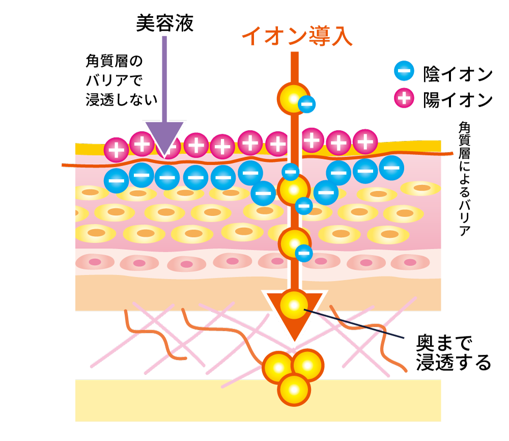 イオン導入の特徴