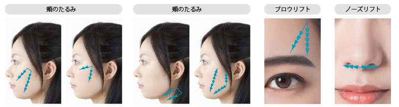 シルエットソフトについて