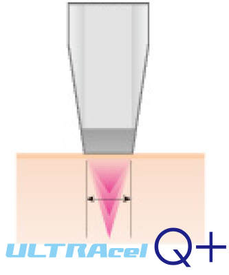 ULTRAcelQ＋(ウルトラセル)について